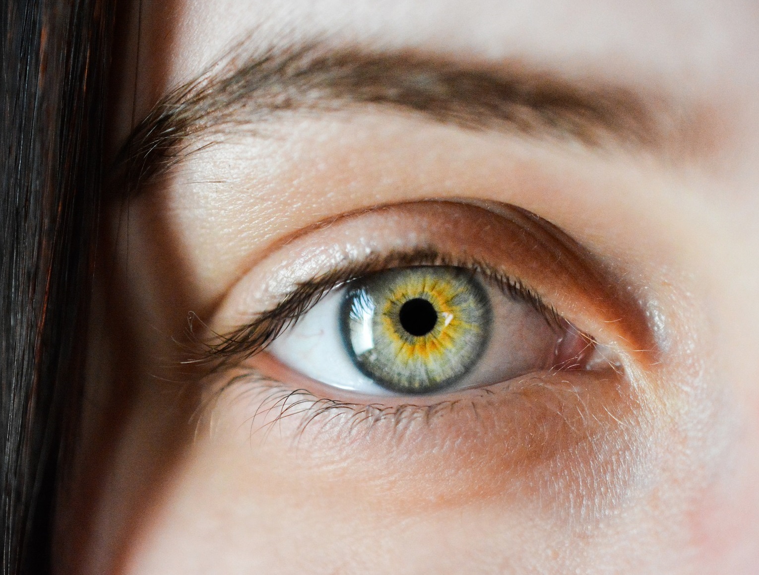 yellow green eye color